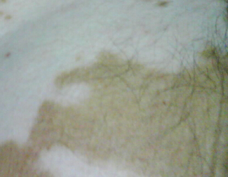 人ưҽԺлϰܿ